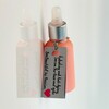 Tiny 20210407153601 42ab6b75 serum me antirytidiki
